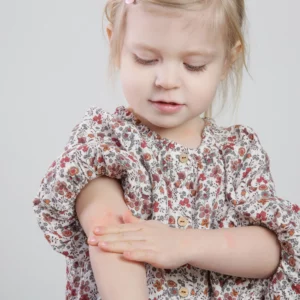 eczéma enfant solutions naturelles