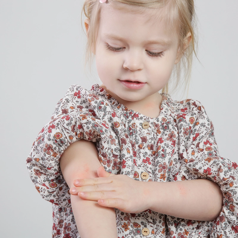 eczéma enfant solutions naturelles