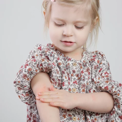 eczéma enfant solutions naturelles