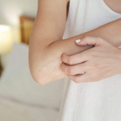 savon-eczema-klapotis savon-eczema-klapotis